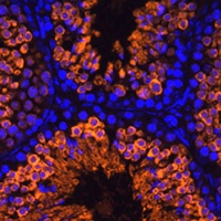 LDHC Rabbit Polyclonal Antibody