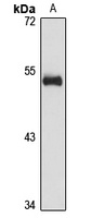 NOL55 Rabbit Polyclonal Antibody