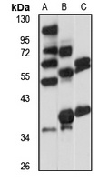 Galectin 4 Rabbit Polyclonal Antibody