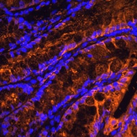 Galectin 4 Rabbit Polyclonal Antibody