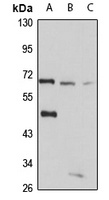 LGI1 Antibody