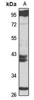 LIN28A Rabbit Polyclonal Antibody