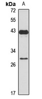 LIN28B Rabbit Polyclonal Antibody
