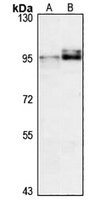 LOXL2 Rabbit Polyclonal Antibody