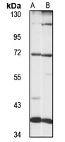 LRRFIP1 Antibody