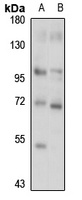 MAN1A1 Rabbit Polyclonal Antibody
