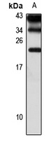 MCTS1 Rabbit Polyclonal Antibody