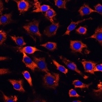 MCTS1 Rabbit Polyclonal Antibody