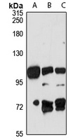 MDGA2 Rabbit Polyclonal Antibody