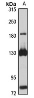 MGAM Rabbit Polyclonal Antibody