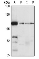 MIB2 Rabbit Polyclonal Antibody