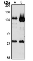 MICAL1 Rabbit Polyclonal Antibody
