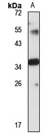 MLKL Rabbit Polyclonal Antibody