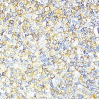 MLKL Rabbit Polyclonal Antibody