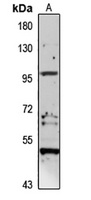 NEP2 Rabbit Polyclonal Antibody
