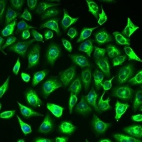 Multimerin-1 Rabbit Polyclonal Antibody