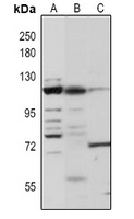 ZCWCC1 Rabbit Polyclonal Antibody