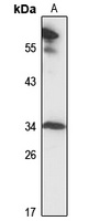 MRPL2 Rabbit Polyclonal Antibody