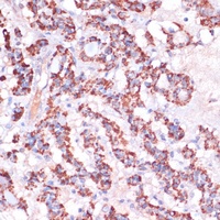 MRPL23 Antibody