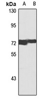 MTA2 Rabbit Polyclonal Antibody
