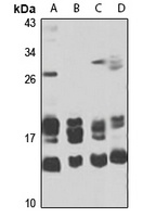 MT-ND3 Rabbit Polyclonal Antibody