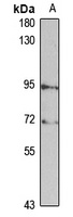 MUSK Rabbit Polyclonal Antibody