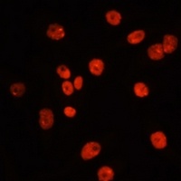 MTLC Rabbit Polyclonal Antibody