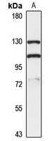 MYO1E Rabbit Polyclonal Antibody