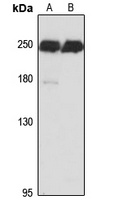 Myoferlin Rabbit Polyclonal Antibody