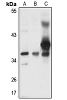 Myozenin-1 Rabbit Polyclonal Antibody