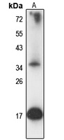 MZB1 Rabbit Polyclonal Antibody