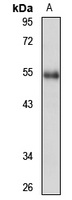 NAB1 Rabbit Polyclonal Antibody