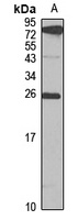 NAT-8B Rabbit Polyclonal Antibody