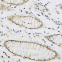 NAT-8B Rabbit Polyclonal Antibody
