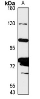NCAPG Rabbit Polyclonal Antibody