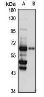 NCOA5 Rabbit Polyclonal Antibody