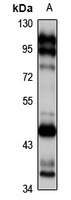 CD336 Rabbit Polyclonal Antibody