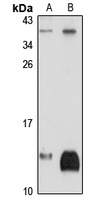 NDUFAB1 Antibody
