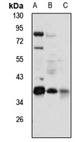 NDUFAF1 Rabbit Polyclonal Antibody