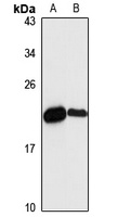 NDUFAF2 Antibody