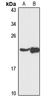 NDUFAF4 Rabbit Polyclonal Antibody