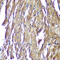 NDUFAF4 Rabbit Polyclonal Antibody