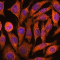 NDUFAF4 Rabbit Polyclonal Antibody