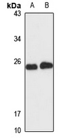 NDUFS8 Rabbit Polyclonal Antibody