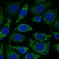 NDUFS8 Rabbit Polyclonal Antibody