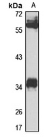 NEK6 Rabbit Polyclonal Antibody
