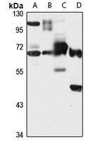 NELF-B Rabbit Polyclonal Antibody