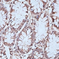 NFE2L1 Rabbit Polyclonal Antibody