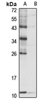 NHP2L1 Rabbit Polyclonal Antibody