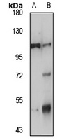 NLRP6 Antibody